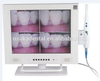15 Inch Screen Dental Intraoral Camera with Wi-Fi