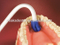 dental disposable saliva ejector/suction tip