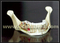 Dental shape of Teeth implant Teaching Model