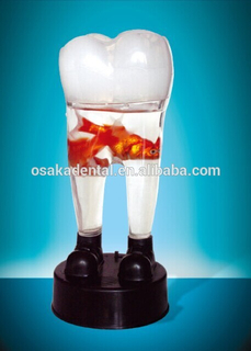 small fish bowl /dental decoration/dental gifts/dental cultural products