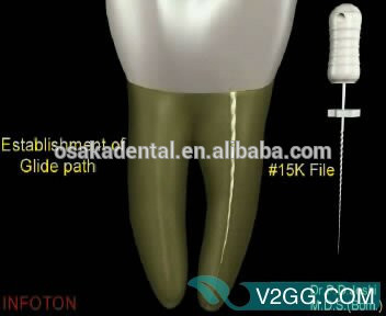 OSAKA DENTAL Cheap price K Files handuse good quality Root Canal File /dental surgical Instrument with CE