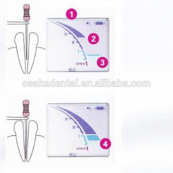 Dental apex locator SM-DP-ZX