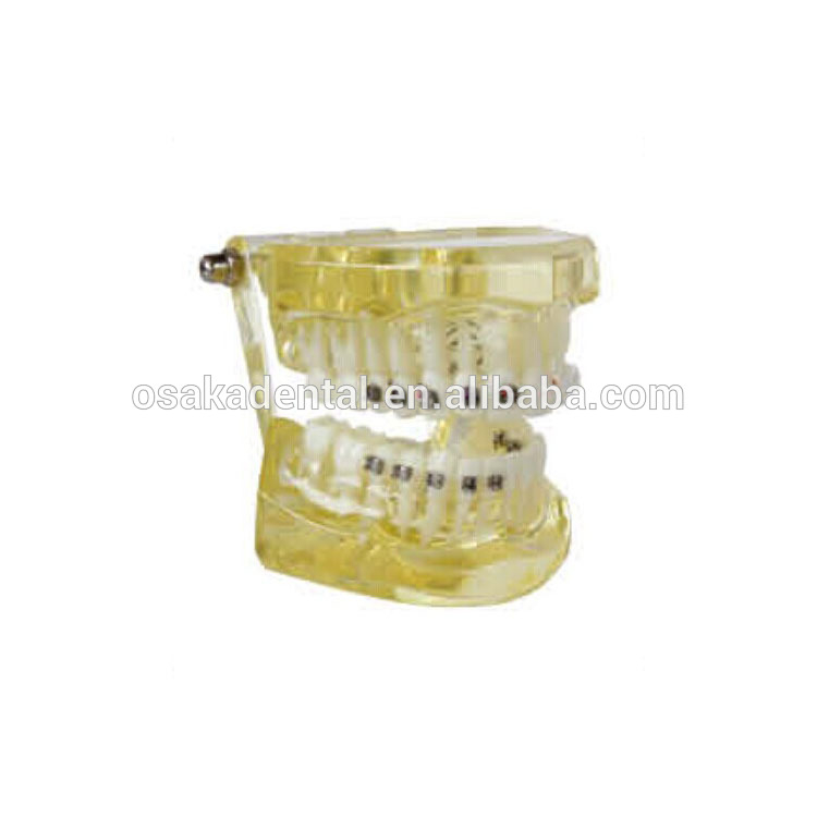 Teeth Model for Student Teaching