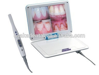 Build in battery super cam USB endoscope camera with 12.1 inch LCD usb mini oral camera/endoscope