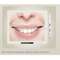 OSA-2 High Class Dental Curing Chair with Surgical Lamp for Implanted Used