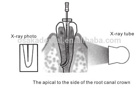 High Accuracy OSAKA Dental Apex Locator for root apex