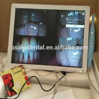17inch white monitor +Dental Intraoral Camera with VGA+VIDEO+US B +monitor holder
