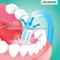 dental disposable saliva ejector/suction tip