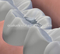 Digital dental Amalgamator TPC-D650/ dental equipment /with CE approved