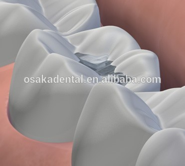 Digital dental Amalgamator TPC-D650/ dental equipment /with CE approved
