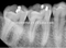 Dental Wall Mounted with CE approved X ray Machine