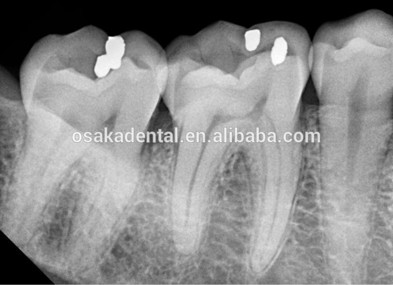 Dental Wall Mounted with CE approved X ray Machine