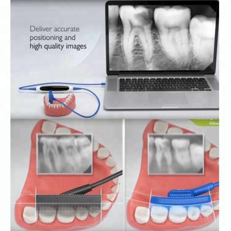 A New Korea EZ Digital Dental Soft X-ray Sensor