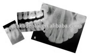 Hot Sale CE approved Dental X-Ray Film Processor