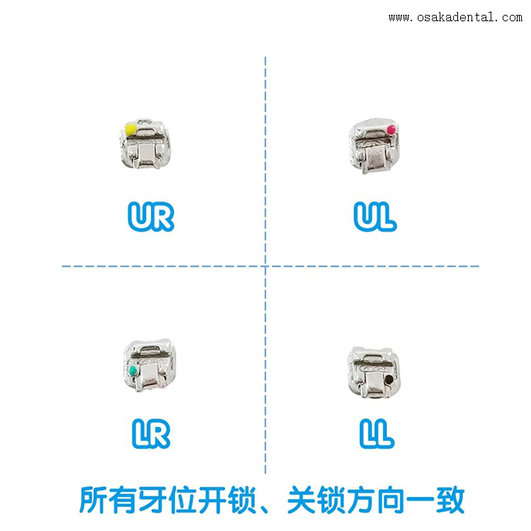 Dental Passive Self-ligating Orthodontic Bracket