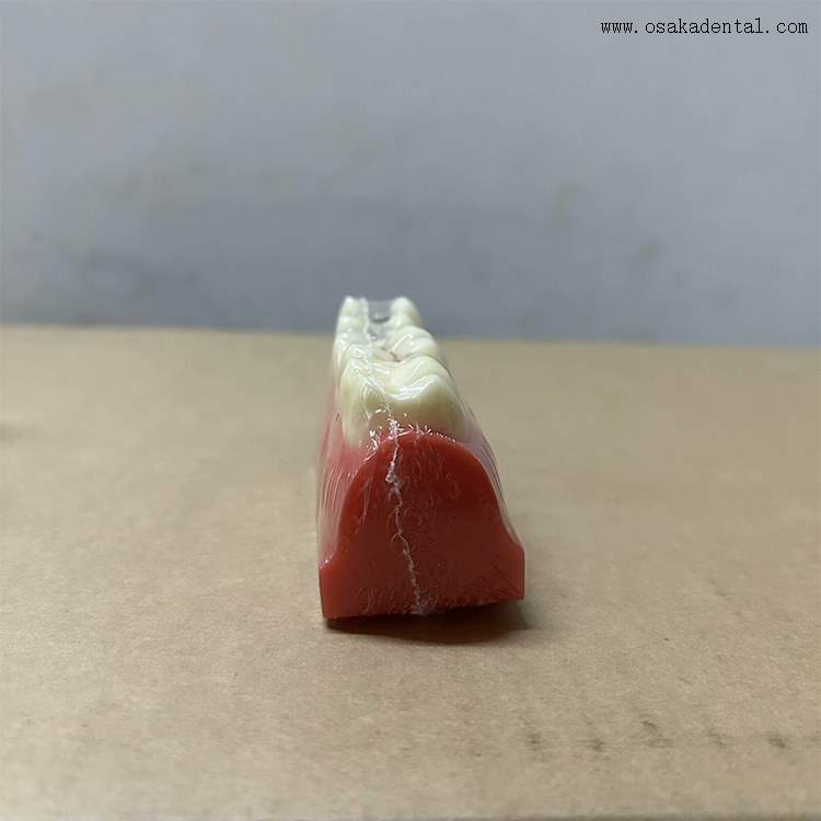 Dental Pit And Fissure Sealant Demonstration Model 