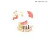 Dental Implant Restoration Comparison Model for Dentist Teaching