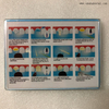 English Packing Economical Fiber Post and Drill for Dental Clinic