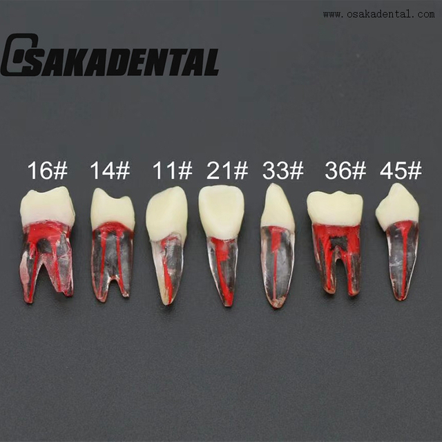 Dental Endodontic Root Canal Train Tooth Model