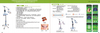 Professional Tooth Bleaching System with Tray whienning unit