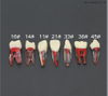 Dentist Students Teaching Practice Resin Teeth Model