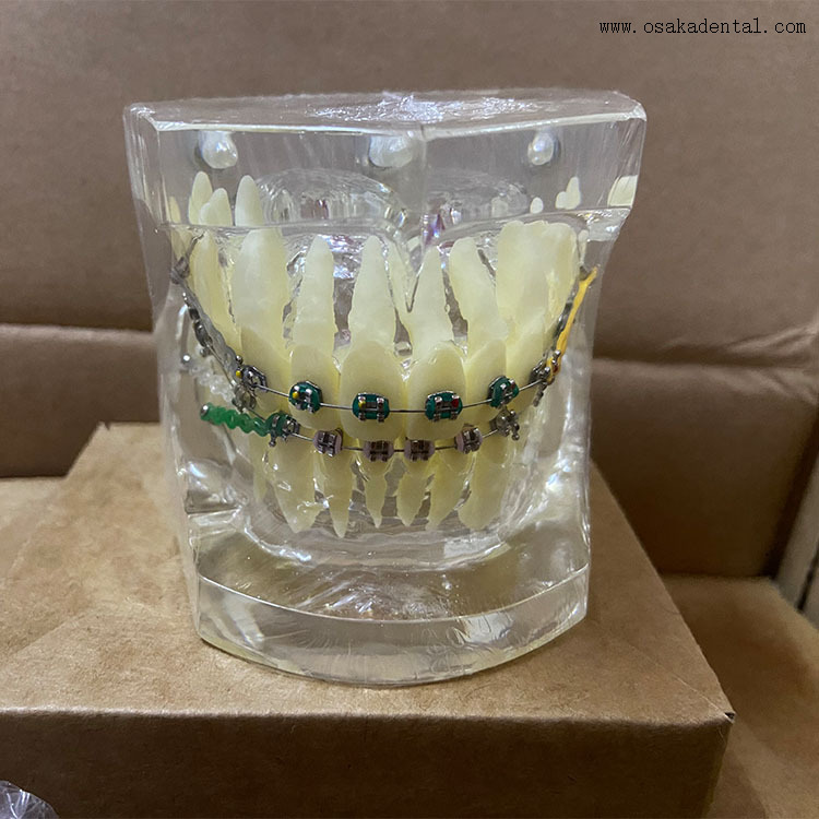 Dental Teeth Orthodontic Model for Dentist Teaching