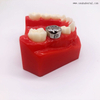 Dental Orthodontic Stainless Steel Kids Crown OSA-P30