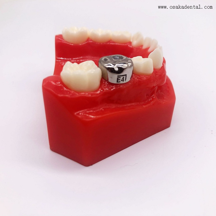 Dental Orthodontic Stainless Steel Kids Crown OSA-P30