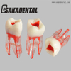 Dental Endodontic Root Canal Train Tooth Model
