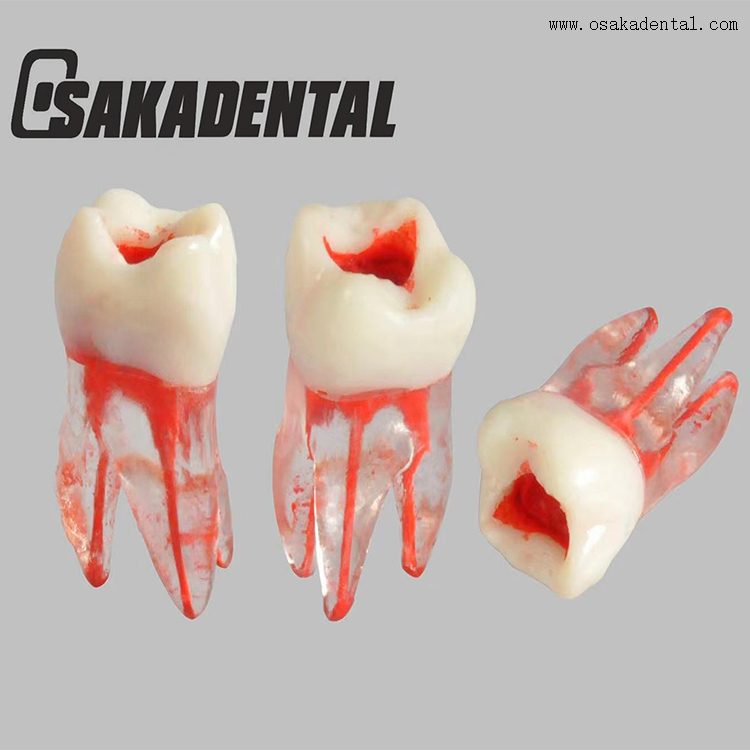 Dental Endodontic Root Canal Train Tooth Model