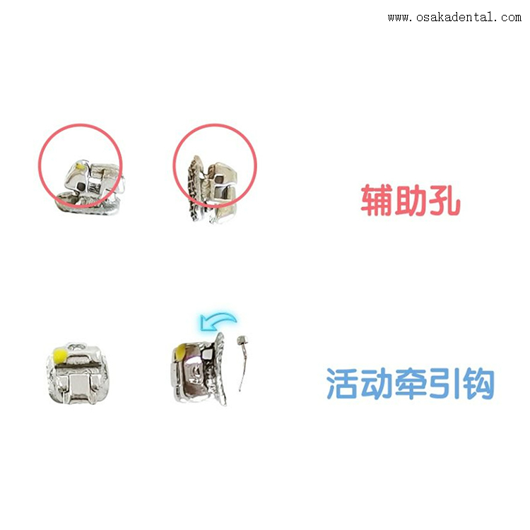 Dental Passive Self-ligating Orthodontic Bracket