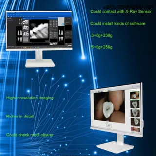 24 Inch Touch Screen Dental Oral Camera with Computer
