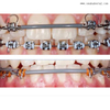 Dental Orthodontic Archwire Sleeve