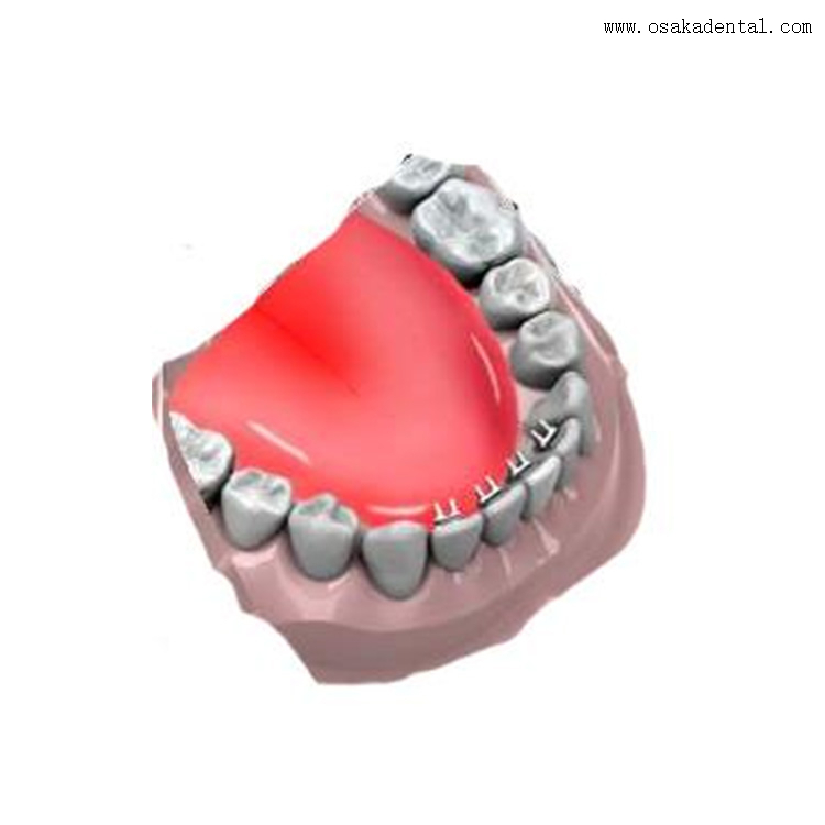Dental Orthodontic Accessories Lingual Spur Mini Educator