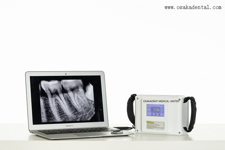 Good quality Dental Portable X-ray Unit OSA-F058E