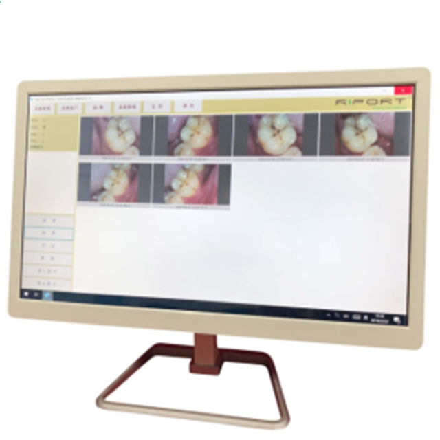 Computer Systerm with Touch Screen Dental Intraoral Camera And Monitor for Dental Chair