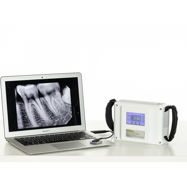 Stable Dental Wireless Digital X Ray Unit