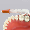 Dental Disposable Wingless Retainer And Matrix Band