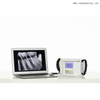 Dental Equipment Dental Portable X Ray Unit