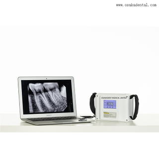 Dental Equipment Dental Portable X Ray Unit