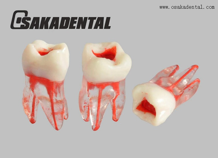 Dental Root Canal Teeth Study Molde 