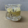 Dental Teeth Pathology Model for Dentist Teaching