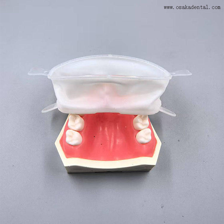 Dental Consumable High Quality Complete Mouth Opener