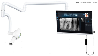 Dental digital sensor with dental x ray machine for dental clinical use