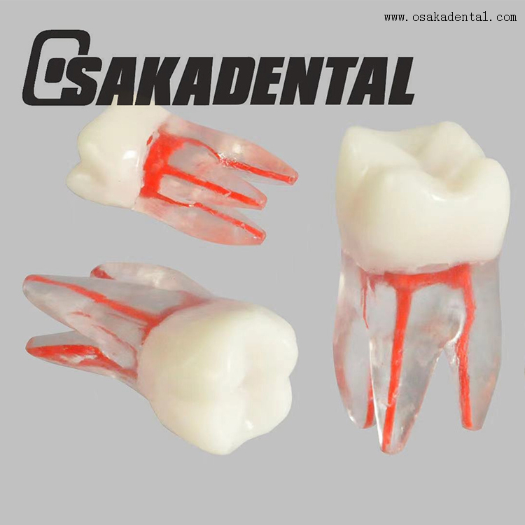 Dental Endodontic Root Canal Train Tooth Model