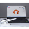 Dental Intraoral Scanner 3D
