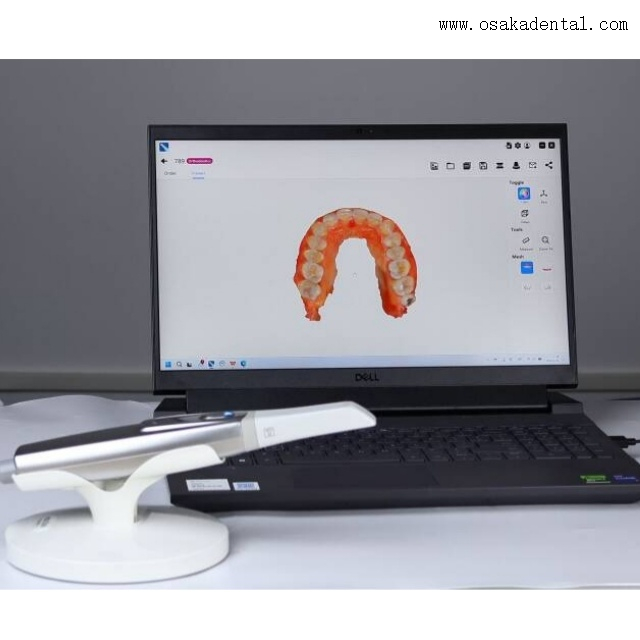 Dental Intraoral Scanner 3D