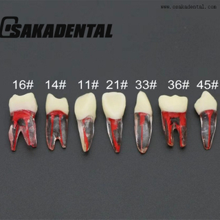 Dental Root Canal Teeth Study Molde 