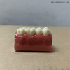 Dental Pit And Fissure Sealant Demonstration Model 
