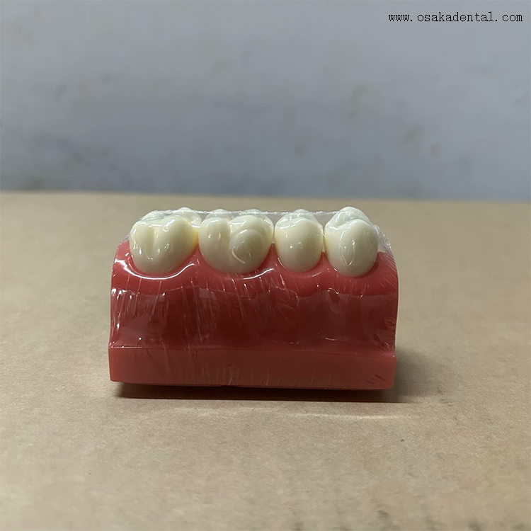 Dental Pit And Fissure Sealant Demonstration Model 